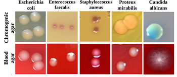 Discrimination of urinary infections using hyperspectral analysis