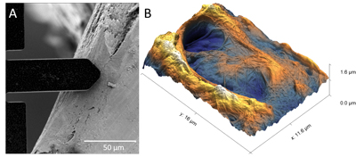 Fig. 1: Correlative analysis of bone collagen fibers with SEM and AFM