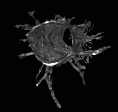 Angiogenetic sprouting  (courtesy of Prof. Yukiko T. Matsunaga)