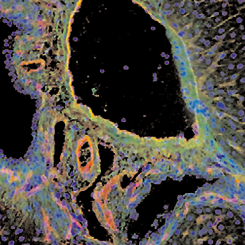 Filtres pour analyse de fluorescence - Filtres de ligne laser