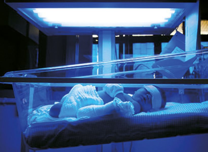 Neonatal jaundice bilirubin therapy lighting